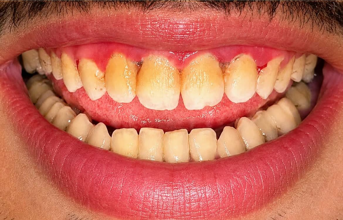 Vues photographiques cliniques d’un sourire, détails visibles — Vue 2